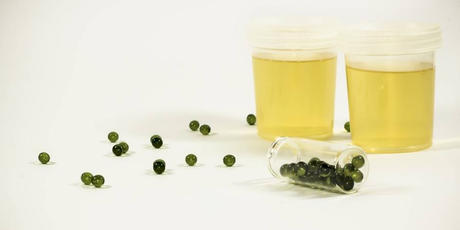 What Drives Interest in Fetish Urine?