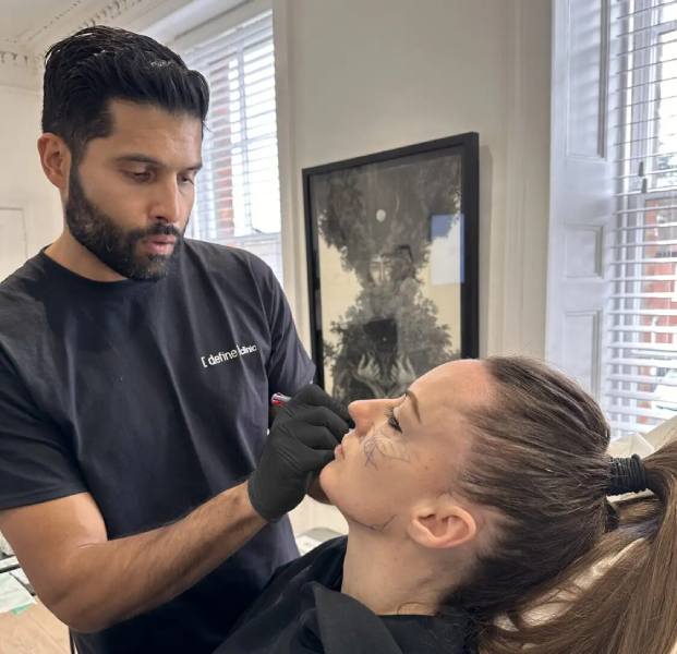The Honest Timeline of Botox in London, from Consultation to Review